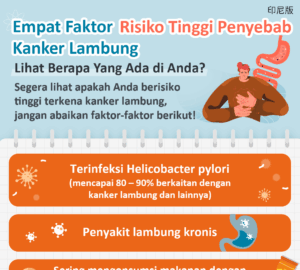 Empat Faktor Risiko Tinggi Penyebab Kanker Lambung